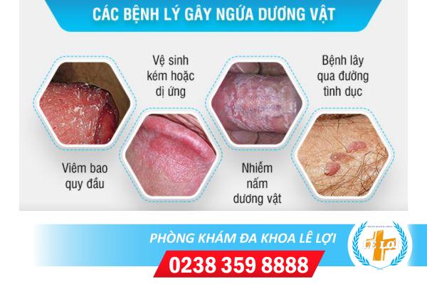 Hiện tượng bị ngứa dương vật và những kiến thức cần biết