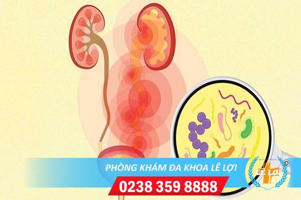 Nhiễm trùng tiểu có nguy hiểm không và hỗ trợ điều trị thế nào?
