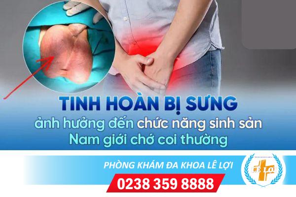 Hiện tượng sưng tinh hoàn và các kiến thức cần biết