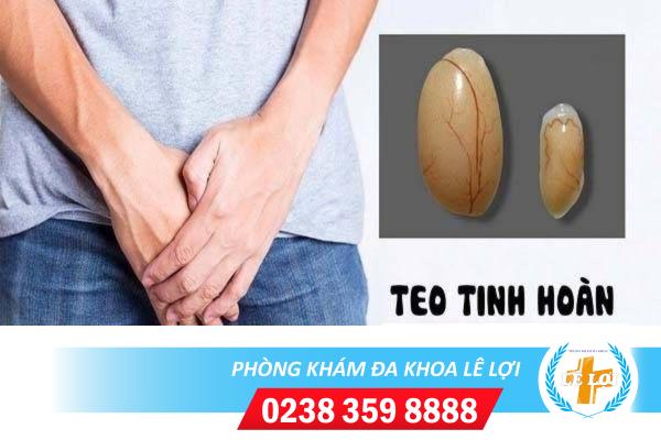 Nguy cơ mất cơ hội làm cha khi bị teo tinh hoàn