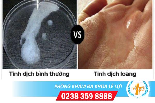 Tinh trùng loãng là như thế nào biểu hiện và cách khắc phục