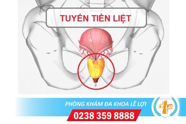 Địa chỉ hỗ trợ chữa viêm tuyến tiền liệt hiệu quả tại Nghệ An