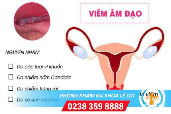 Dấu hiệu nhận biết bị viêm âm đạo