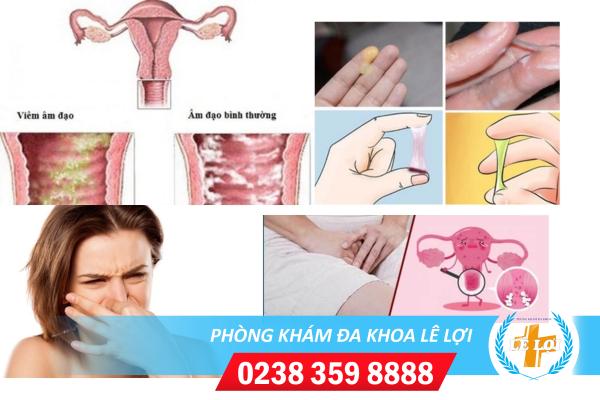 Viêm âm đạo có ảnh hưởng gì không?