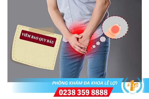 Các triệu chứng viêm bao quy đầu nguy hiểm nam giới nên biết