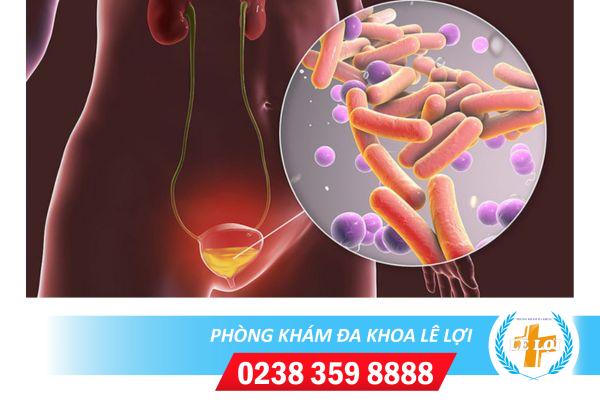 Viêm đường tiểu ở nam và nữ có nguy hiểm không và xử lý thế nào