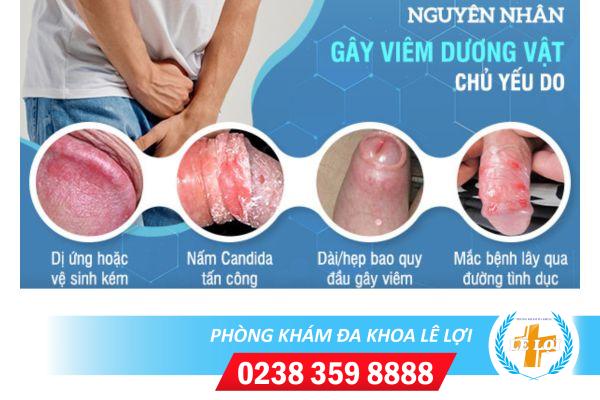 viem-duong-vat