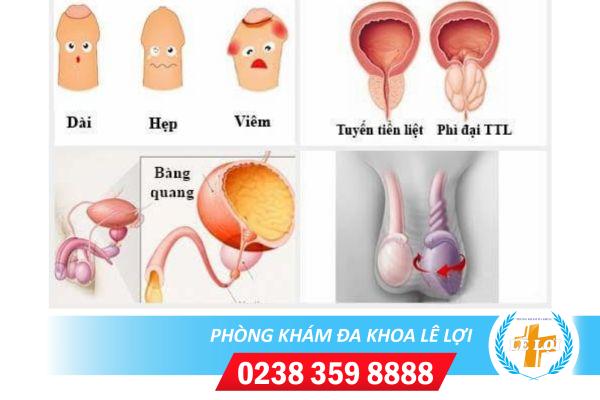 Chữa viêm nam khoa ở đâu hiệu quả tại Nghệ An?