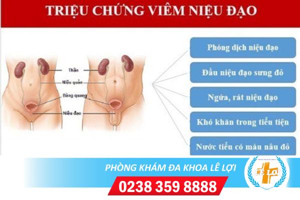 Hiện tượng viêm niệu đạo ở nữ giới