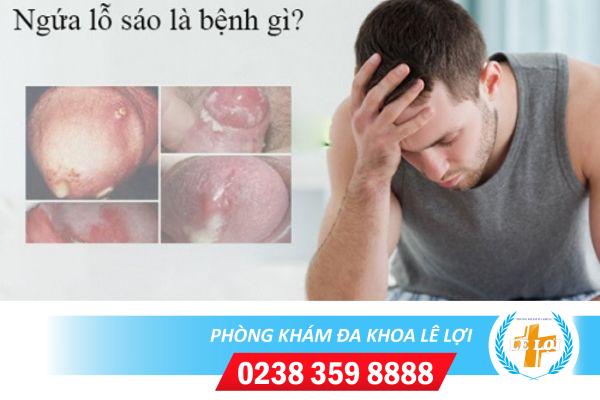 Những nguy hiểm tiềm ẩn từ dấu hiệu ngứa niệu đạo