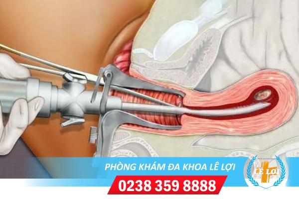 Những điều cần chú ý trước và sau khi hút thai. Lời khuyên của bác sĩ với sức khỏe thai sản