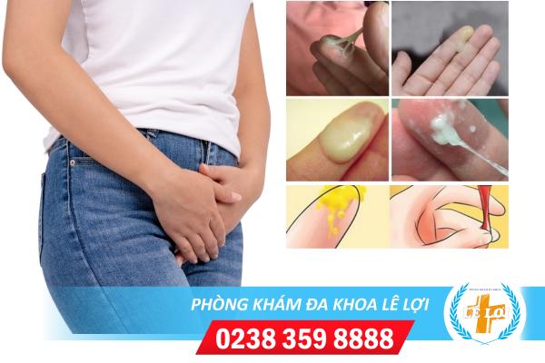 Khí hư có màu và mùi bất thường cảnh báo bệnh gì?