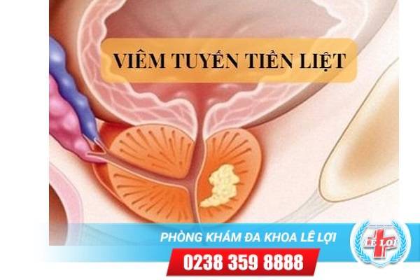 Nguyên nhân viêm tuyến tiền liệt do đâu?