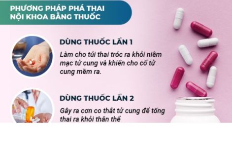 Đặt thuốc phá thai như thế nào là an toàn?