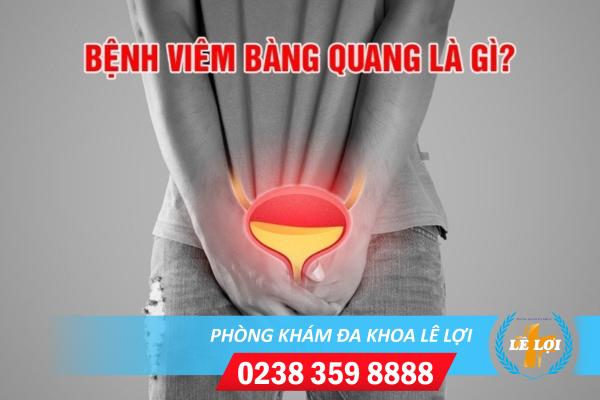 Triệu chứng của bệnh viêm bàng quang