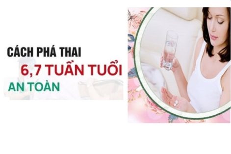 Cách dùng thuốc phá thai từ 6-7 tuần