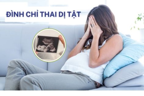 Đình chỉ thai dị tật như thế nào an toàn?