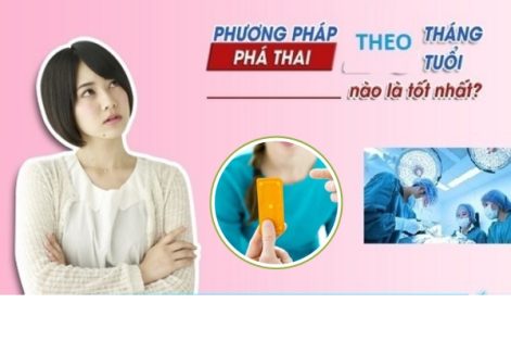 Các phương pháp phá thai theo tháng an toàn