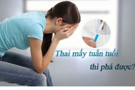 Thai bao nhiêu tuần thì phá được?