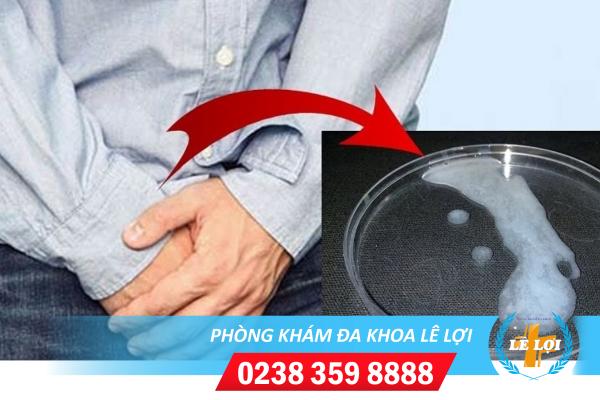 Cách chữa tinh trùng vón cục hiệu quả hiện nay