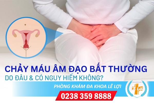 Tự nhiên âm đạo bị chảy máu nguyên nhân do đâu?