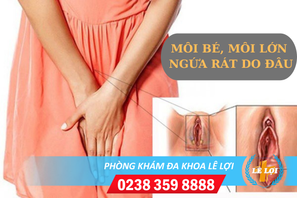 Nguyên nhân gây ngứa môi bé môi lớn và cách điều trị