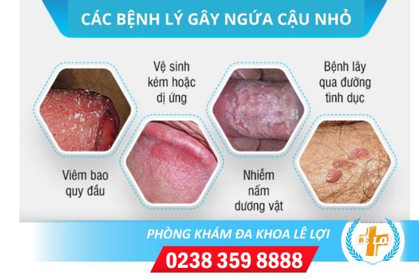 Ngứa cậu nhỏ là mắc bệnh gì giải pháp điều trị