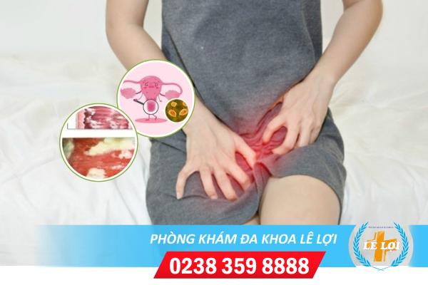 Ngứa mép âm đạo vùng kín phải làm sao?