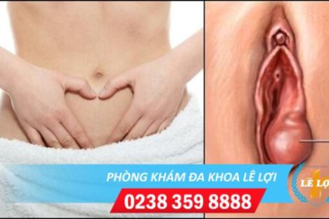 Sưng môi bé môi lớn vùng kín nguy hiểm không?