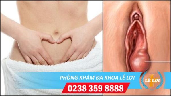 Sưng môi bé môi lớn vùng kín nguy hiểm không?