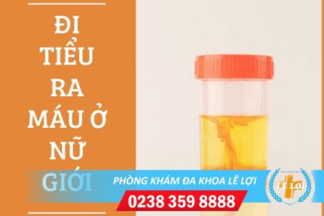 Đi tiểu buốt ra máu là dấu hiệu bệnh gì?