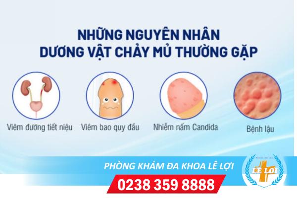 Dương vật chảy mủ là bị bệnh gì?