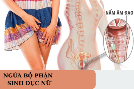 Đừng chủ quan khi bị ngứa bộ phận sinh dục nữ