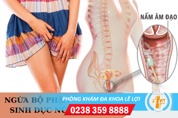 Đừng chủ quan khi bị ngứa bộ phận sinh dục nữ