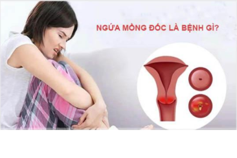 Nguyên nhân ngứa mồng đốc cách làm dịu cơn ngứa