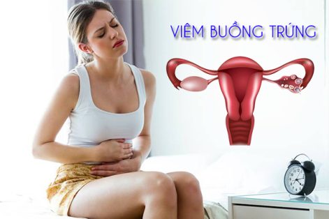 Bạn hiểu gì về bệnh viêm buồng trứng?