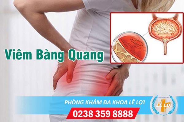 Dấu hiệu nhận biết viêm bàng quang ở nữ và cách chữa hiệu quả