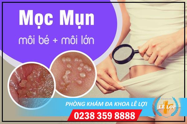 Hết sức lưu ý tình trạng mọc mụn môi bé, môi lớn