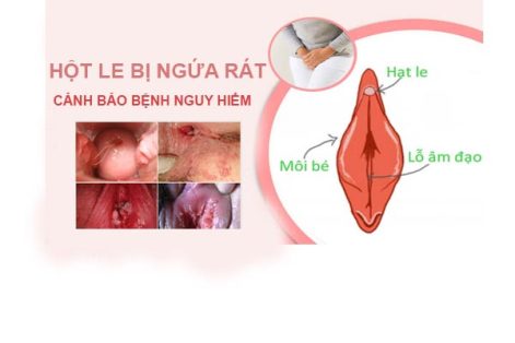 Hột le bị ngứa rát là bị bệnh gì nguy hiểm không?