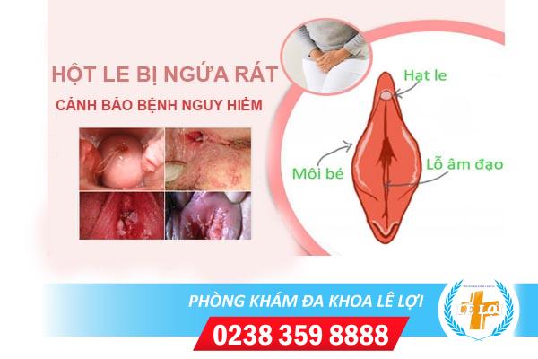 Hột le bị ngứa rát là bị bệnh gì nguy hiểm không?