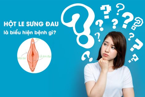 Hột le bị sưng đau là biểu hiện bệnh gì? Có điều trị được không?