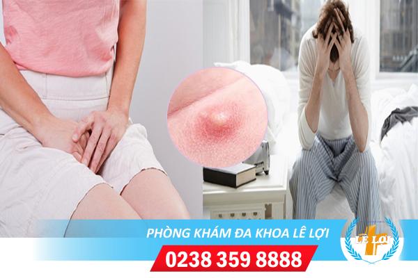 Tại sao nổi mụn nhọt vùng kín và cách điều trị