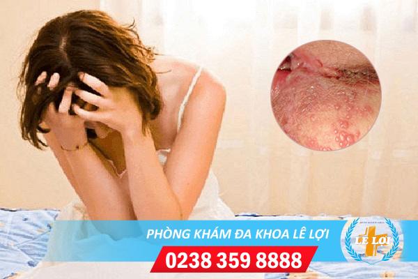 Mụn nước môi bé là dấu hiệu bệnh gì?