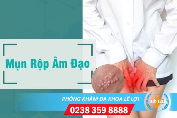 Mụn rộp âm đạo và những thông tin quan trọng cần lưu ý