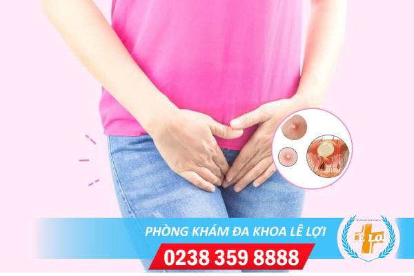 Nổi mụn trắng âm đạo – Cảnh báo bệnh xã hội nguy hiểm