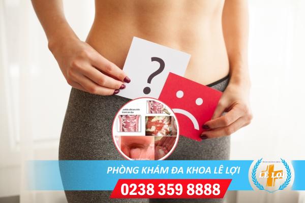 Nguyên nhân nhiễm khuẩn nhiễm trùng âm đạo và cách chữa