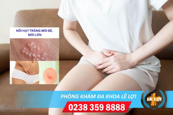 Cẩn trọng với tình trạng nổi hạt trắng môi lớn, môi bé