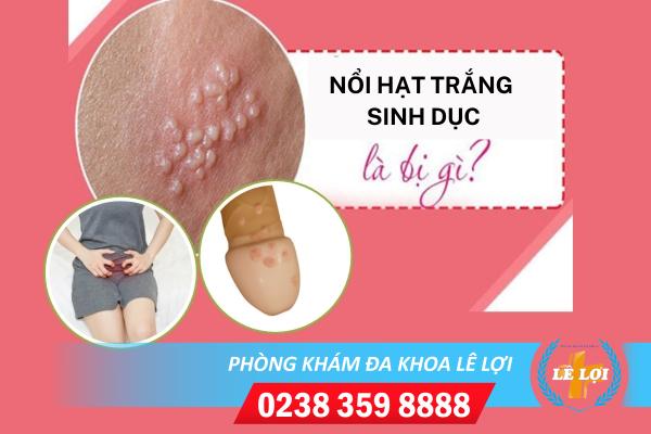 Tình trạng nổi hạt trắng sinh dục là bệnh gì? 