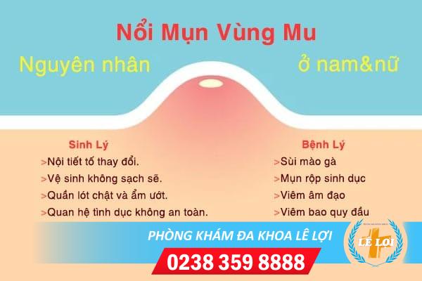 Nổi mụn vùng mu ở nam và nữ – Nguyên nhân và cách chữa hiệu quả