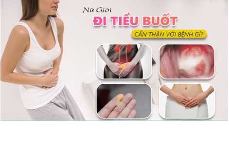 Nguyên nhân bị tiểu buốt sau quan hệ ở nữ giới